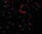 Receptor-interacting serine/threonine-protein kinase 1 antibody, orb89840, Biorbyt, Immunofluorescence image 
