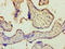 Zinc Finger RANBP2-Type Containing 2 antibody, A54601-100, Epigentek, Immunohistochemistry paraffin image 