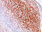 Complement C3b/C4b Receptor 1 (Knops Blood Group) antibody, AM50104PU-S, Origene, Immunohistochemistry paraffin image 