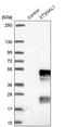 ST3 Beta-Galactoside Alpha-2,3-Sialyltransferase 1 antibody, PA5-59190, Invitrogen Antibodies, Western Blot image 