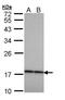 Crystallin Beta A4 antibody, TA308870, Origene, Western Blot image 