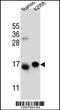 Eukaryotic Translation Initiation Factor 5A Like 1 antibody, 56-158, ProSci, Western Blot image 