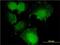 CCR4-NOT transcription complex subunit 7 antibody, H00029883-M01, Novus Biologicals, Immunocytochemistry image 