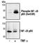 p65 antibody, MA5-15181, Invitrogen Antibodies, Western Blot image 