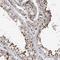 SDE2 Telomere Maintenance Homolog antibody, HPA031255, Atlas Antibodies, Immunohistochemistry paraffin image 