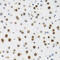 H2A Histone Family Member X antibody, 13-997, ProSci, Immunohistochemistry paraffin image 
