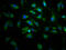 ATP Binding Cassette Subfamily C Member 8 antibody, LS-C671189, Lifespan Biosciences, Immunofluorescence image 