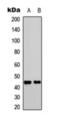 C-X-C Motif Chemokine Receptor 2 antibody, orb393263, Biorbyt, Western Blot image 