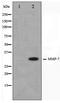 Matrix Metallopeptidase 7 antibody, TA347437, Origene, Western Blot image 