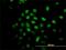 Calcium Responsive Transcription Factor antibody, H00079800-M01, Novus Biologicals, Immunocytochemistry image 