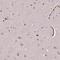 Solute Carrier Family 4 Member 1 (Diego Blood Group) antibody, HPA063911, Atlas Antibodies, Immunohistochemistry paraffin image 