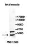L-aminoadipate-semialdehyde dehydrogenase-phosphopantetheinyl transferase antibody, orb77775, Biorbyt, Western Blot image 