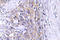 Ceroid-lipofuscinosis neuronal protein 6 antibody, LS-C177359, Lifespan Biosciences, Immunohistochemistry frozen image 