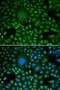 Probable ATP-dependent RNA helicase DDX5 antibody, LS-C748352, Lifespan Biosciences, Immunofluorescence image 