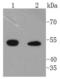 Integrin-linked protein kinase antibody, A02932-1, Boster Biological Technology, Western Blot image 