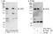 Zinc Finger FYVE-Type Containing 9 antibody, A303-768A, Bethyl Labs, Immunoprecipitation image 