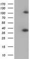 ZFP36 Ring Finger Protein antibody, CF502377, Origene, Western Blot image 
