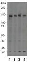 Regulatory Associated Protein Of MTOR Complex 1 antibody, TA303799, Origene, Western Blot image 