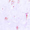 Cathepsin E antibody, GTX56272, GeneTex, Immunohistochemistry paraffin image 