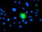 Proteasome 26S Subunit, Non-ATPase 2 antibody, TA503229, Origene, Immunofluorescence image 