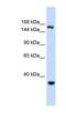 Eukaryotic Translation Initiation Factor 4 Gamma 3 antibody, NBP1-57533, Novus Biologicals, Western Blot image 