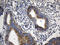 Coiled-coil domain-containing protein 22 antibody, LS-C795785, Lifespan Biosciences, Immunohistochemistry paraffin image 