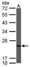 NADH:Ubiquinone Oxidoreductase Subunit B9 antibody, TA308927, Origene, Western Blot image 