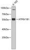 ATPase H+ Transporting V1 Subunit B1 antibody, 19-148, ProSci, Western Blot image 