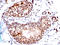 Small Ubiquitin Like Modifier 1 antibody, AM50183PU-S, Origene, Immunohistochemistry frozen image 