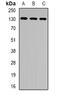 XPC Complex Subunit, DNA Damage Recognition And Repair Factor antibody, orb341479, Biorbyt, Western Blot image 