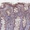 Lysine Rich Coiled-Coil 1 antibody, HPA045618, Atlas Antibodies, Immunohistochemistry paraffin image 