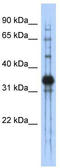 Chondroadherin antibody, TA340000, Origene, Western Blot image 