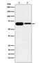 Imp2 antibody, M02010-1, Boster Biological Technology, Western Blot image 
