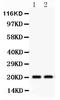 Heat shock protein beta-2 antibody, PA5-79412, Invitrogen Antibodies, Western Blot image 