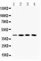 Vasodilator Stimulated Phosphoprotein antibody, A00303-1, Boster Biological Technology, Western Blot image 