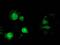 Microtubule-associated protein RP/EB family member 2 antibody, MA5-25550, Invitrogen Antibodies, Immunocytochemistry image 