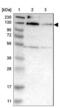 MORC Family CW-Type Zinc Finger 3 antibody, NBP1-83036, Novus Biologicals, Western Blot image 