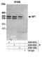 Neurofibromin 1 antibody, A304-931A, Bethyl Labs, Immunoprecipitation image 
