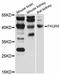 Progestin And AdipoQ Receptor Family Member 8 antibody, STJ114112, St John