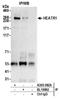 HEAT repeat-containing protein 1 antibody, A305-082A, Bethyl Labs, Immunoprecipitation image 