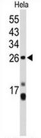 Centromere Protein H antibody, AP50854PU-N, Origene, Western Blot image 
