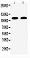 Desmoglein 3 antibody, LS-C312724, Lifespan Biosciences, Western Blot image 