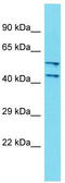 DDB1 And CUL4 Associated Factor 4 Like 2 antibody, TA335387, Origene, Western Blot image 