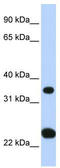 Solute Carrier Family 25 Member 35 antibody, TA334634, Origene, Western Blot image 