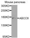 ATP Binding Cassette Subfamily C Member 8 antibody, LS-C409991, Lifespan Biosciences, Western Blot image 