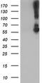 Potassium Voltage-Gated Channel Subfamily J Member 3 antibody, MA5-25845, Invitrogen Antibodies, Western Blot image 