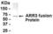 Arrestin 3 antibody, XW-7690, ProSci, Western Blot image 