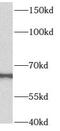 Beta-1,4-N-Acetyl-Galactosaminyltransferase 2 antibody, FNab00772, FineTest, Western Blot image 