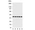 Protein fosB antibody, R30550, NSJ Bioreagents, Western Blot image 