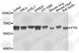 FYN Proto-Oncogene, Src Family Tyrosine Kinase antibody, A0086, ABclonal Technology, Western Blot image 